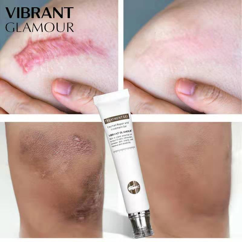 SCAR REMOVAL GEL